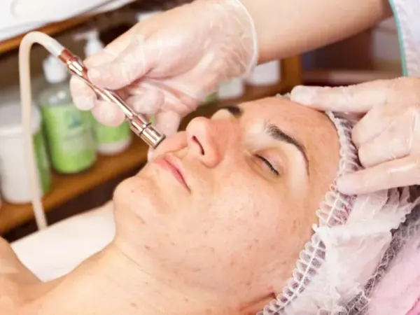 5 professional-treatments-for-single-acne-scar