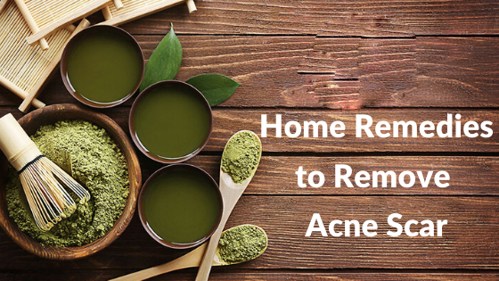 6 home-remedies-for-acne-scars
