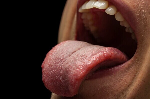 7 complications-of-an-adderall-tongue