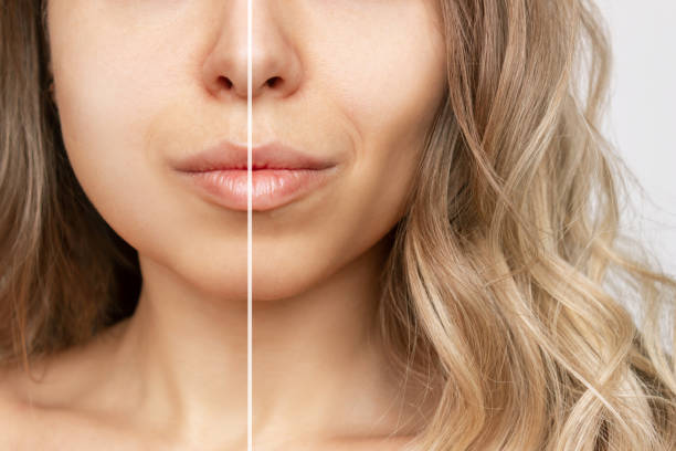 Unlocking Sculpted Cheekbones: A Guide to Achieving Hollow Cheeks